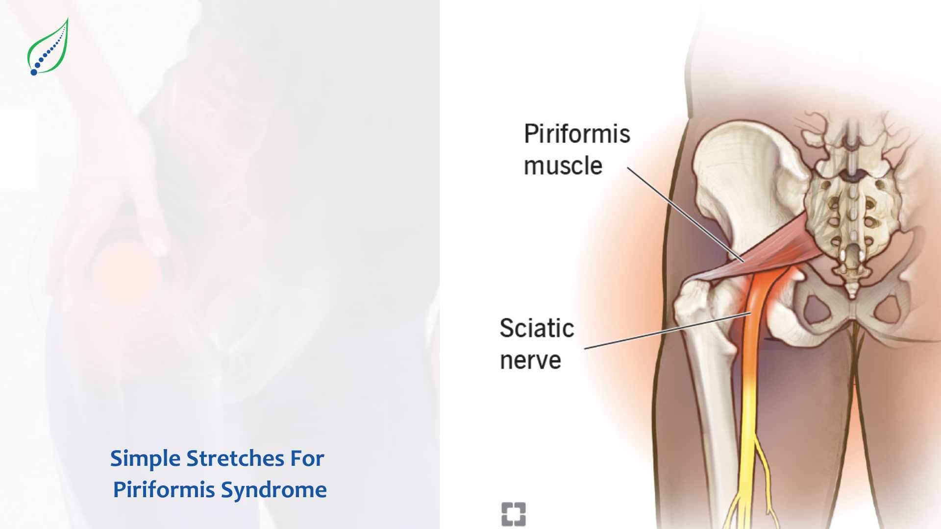 Simple Stretches For Piriformis Syndrome